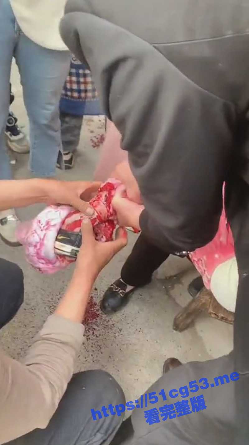 湖南衡阳再现恶犬伤人事件！小女孩被大黑狗死死咬住 狗主人怎么抽打狗就是不松口！ - 51吃瓜网-51吃瓜网